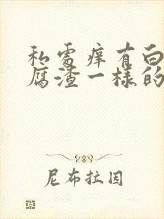 私处痒有白色豆腐渣一样的分泌物