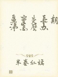 鼻窦炎长期流鼻涕怎么办封面