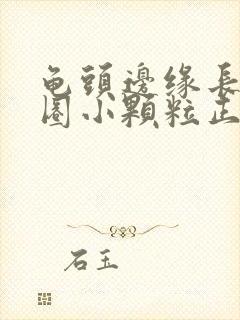 龟头边缘长了一圈小颗粒正常吗封面