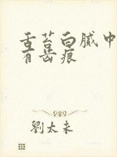 舌苔白腻中间黄有齿痕