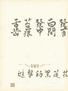 舌苔发白发黄有齿痕中间有裂纹怎么回事