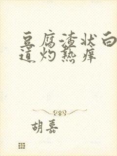 豆腐渣状白带阴道灼热痒