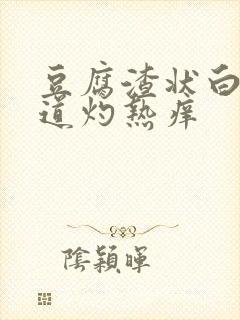 豆腐渣状白带阴道灼热痒封面