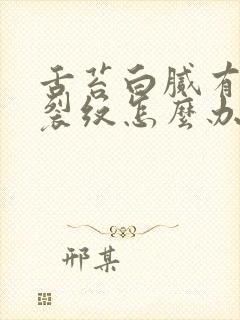 舌苔白腻有齿痕裂纹怎么办