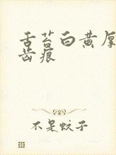 舌苔白黄厚腻有齿痕封面