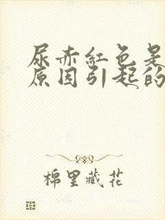 尿赤红色是什么原因引起的封面