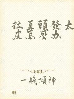 拉直头发太贴头皮怎么办封面