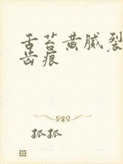 舌苔黄腻裂纹有齿痕