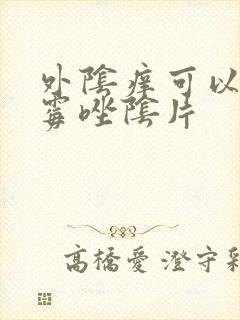 外阴痒可以用克霉唑阴片