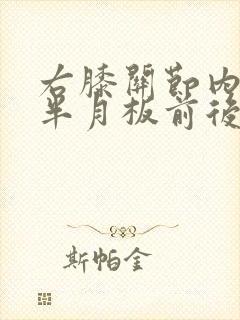 右膝关节内外侧半月板前后角