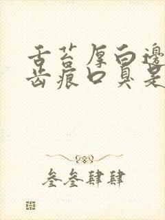 舌苔厚白边缘有齿痕口臭是怎么回事