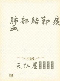 肺部结节痰中有血