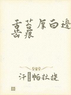 舌苔厚白边缘有齿痕