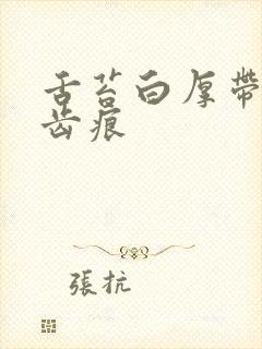 舌苔白厚带腻有齿痕