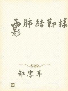 两肺结节样致密影