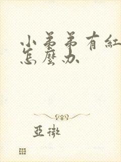 小弟弟有红点痒怎么办