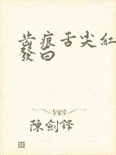 齿痕舌尖红舌苔发白