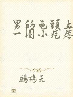 男的龟头上长了一圈小疙瘩封面