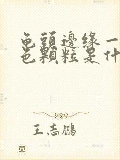 龟头边缘一圈白色颗粒是什么