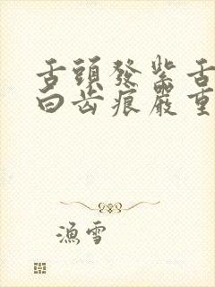 舌头发紫舌苔厚白齿痕严重怎么回事