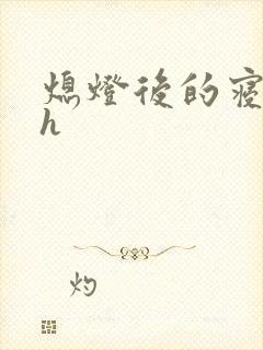 熄灯后的寝室ph