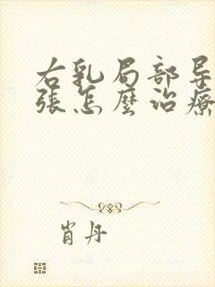 右乳局部导管扩张怎么治疗封面