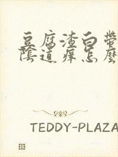 豆腐渣白带很多阴道痒怎么回事