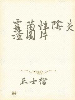 霉菌性阴炎豆腐渣图片