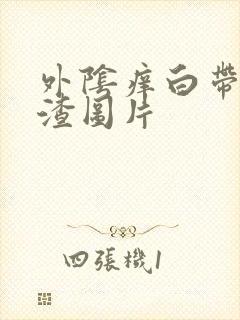 外阴痒白带豆腐渣图片