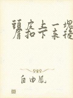 头皮上一块白色屑扣下来后又长了