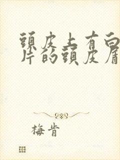 头皮上有白色大片的头皮屑怎么办