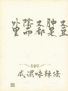 外阴又肿又痒,里面都是豆腐渣