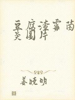 豆腐渣霉菌性阴炎图片