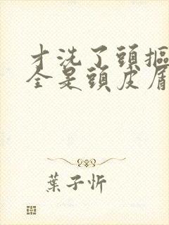 才洗了头抠头皮全是头皮屑