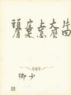 头皮上大片头皮屑是怎么回事