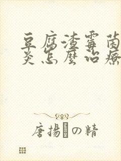 豆腐渣霉菌性阴炎怎么治疗