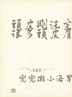 头皮刚洗完头就很多头皮屑