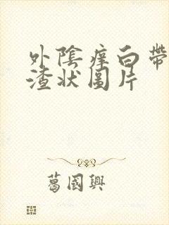 外阴痒白带豆腐渣状图片