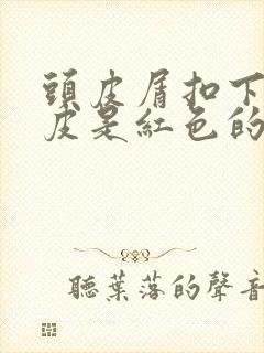 头皮屑扣下来头皮是红色的