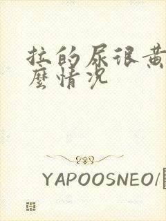 拉的尿很黄是什么情况封面