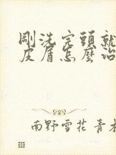 刚洗完头就有头皮屑怎么治疗