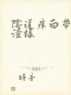 阴道痒白带豆腐渣样