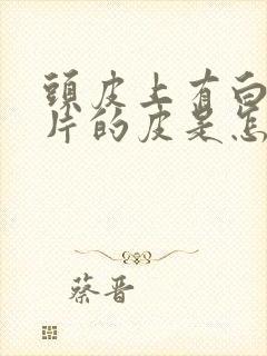 头皮上有白色大片的皮是怎么治疗