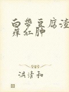 白带豆腐渣外阴痒红肿