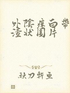 外阴痒白带豆腐渣状图片