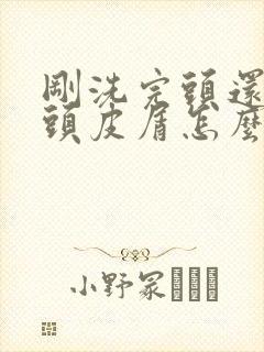 刚洗完头还是有头皮屑怎么办