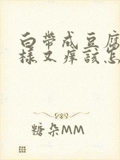 白带成豆腐渣一样又痒该怎么治疗