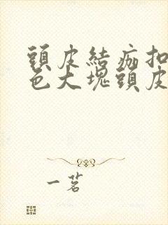 头皮结痂扣下白色大块头皮屑