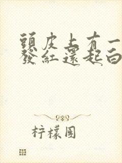 头皮上有一圈圈发红还起白屑