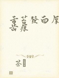 舌苔发白厚腻有齿痕